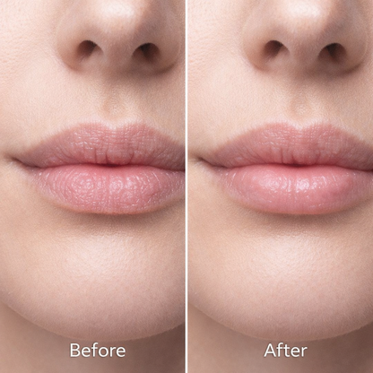 Soothing Lip Peel Mask